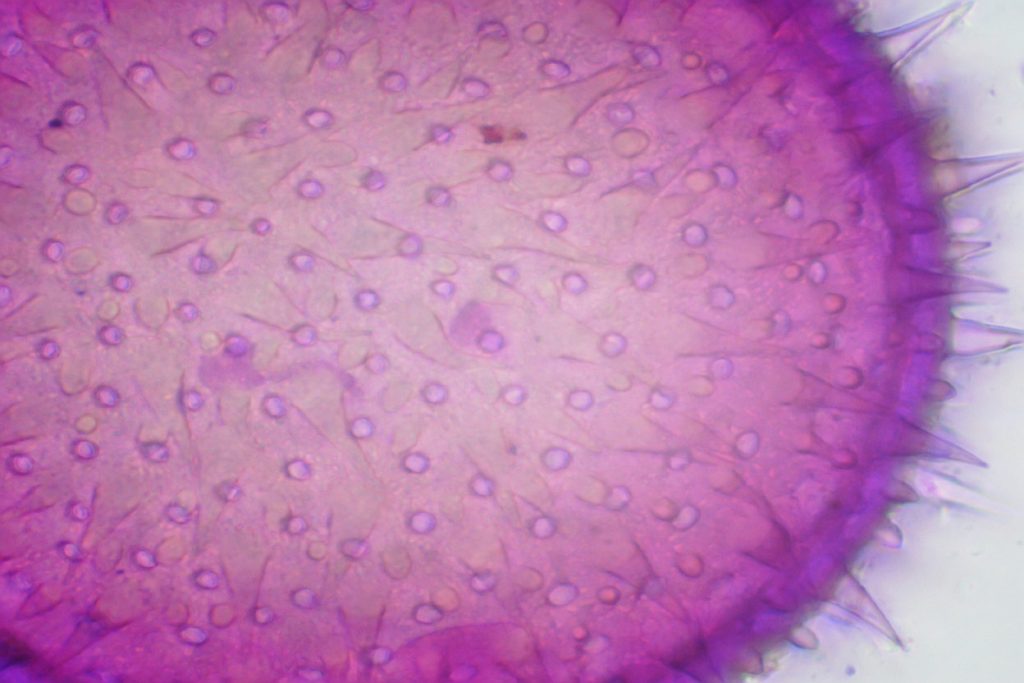 Hollyhock pollen grain under the microscope